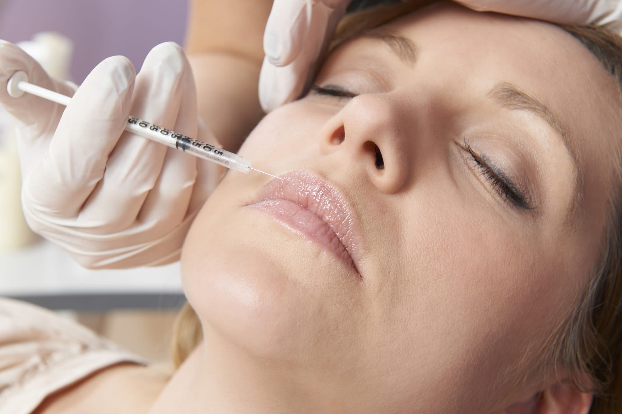 botox injections around the mouth