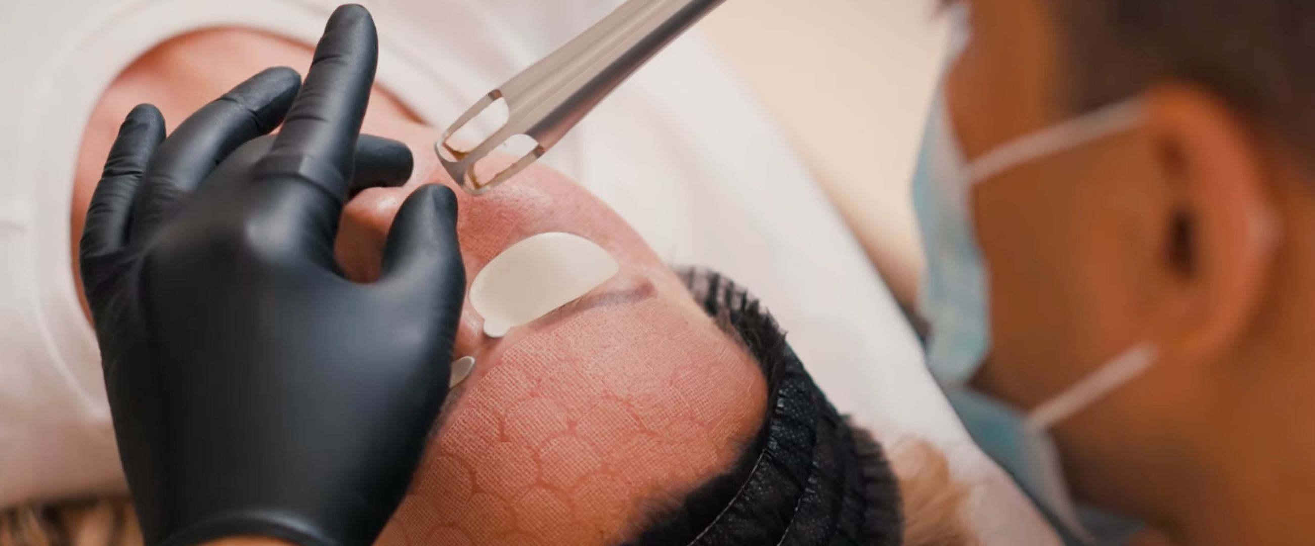 CO2 laser for men and women