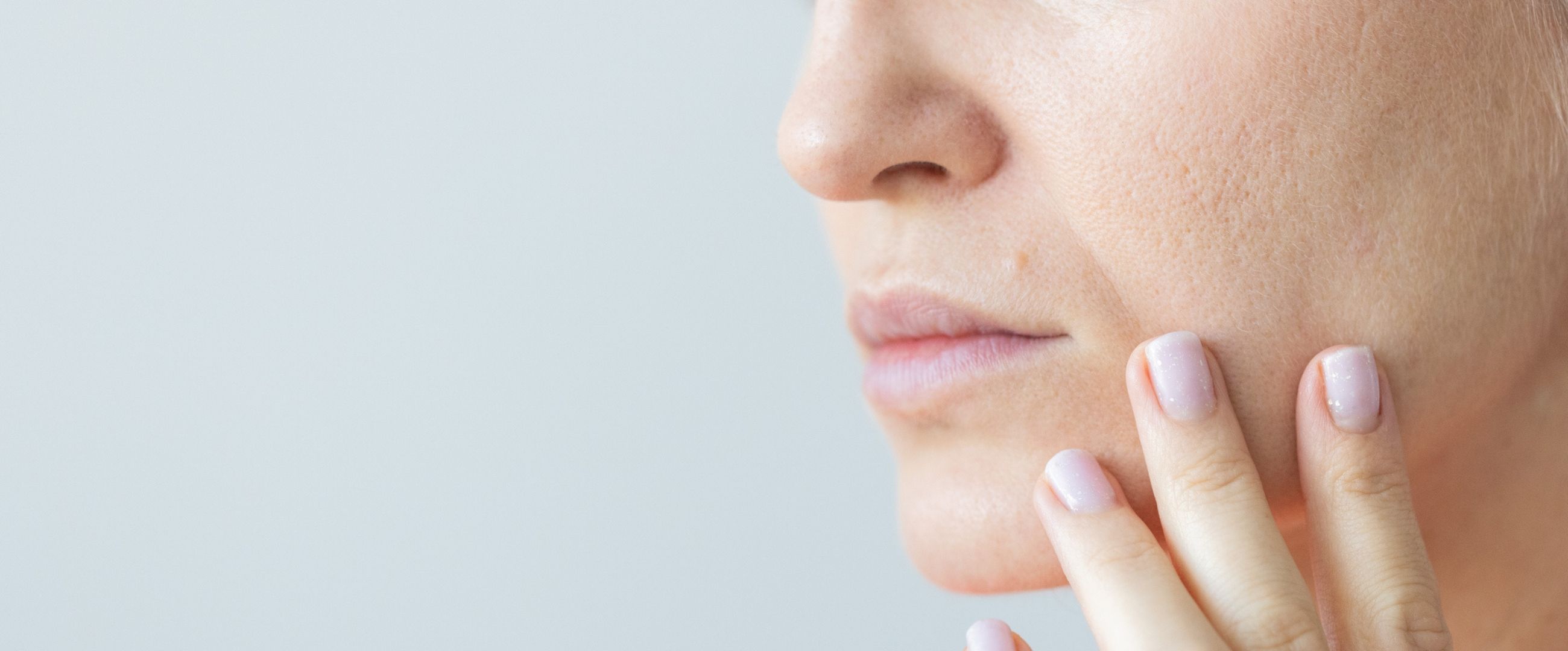 Nasolabial Folds and Marionette Lines woman