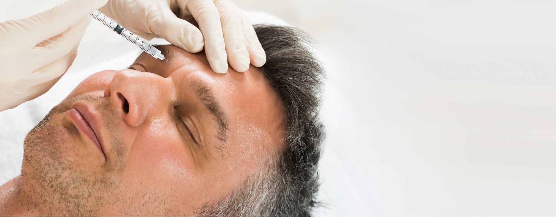 botox-for-between-eyebrows london