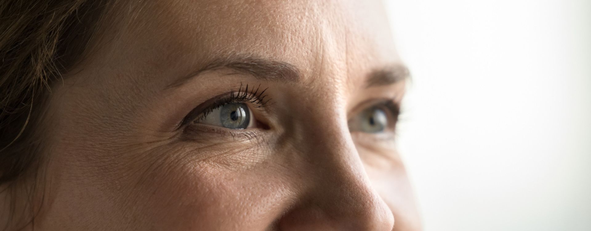 crows feet wrinkles by eyes