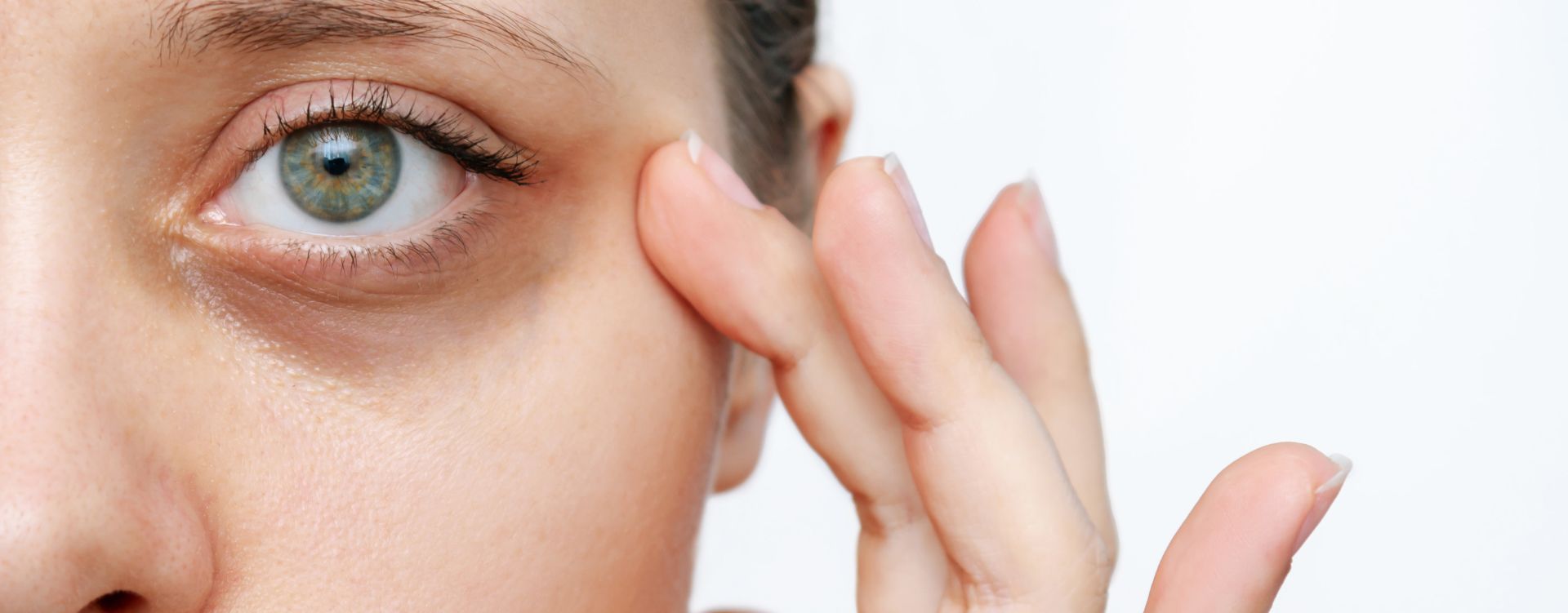 dark circles under eyes treatment london