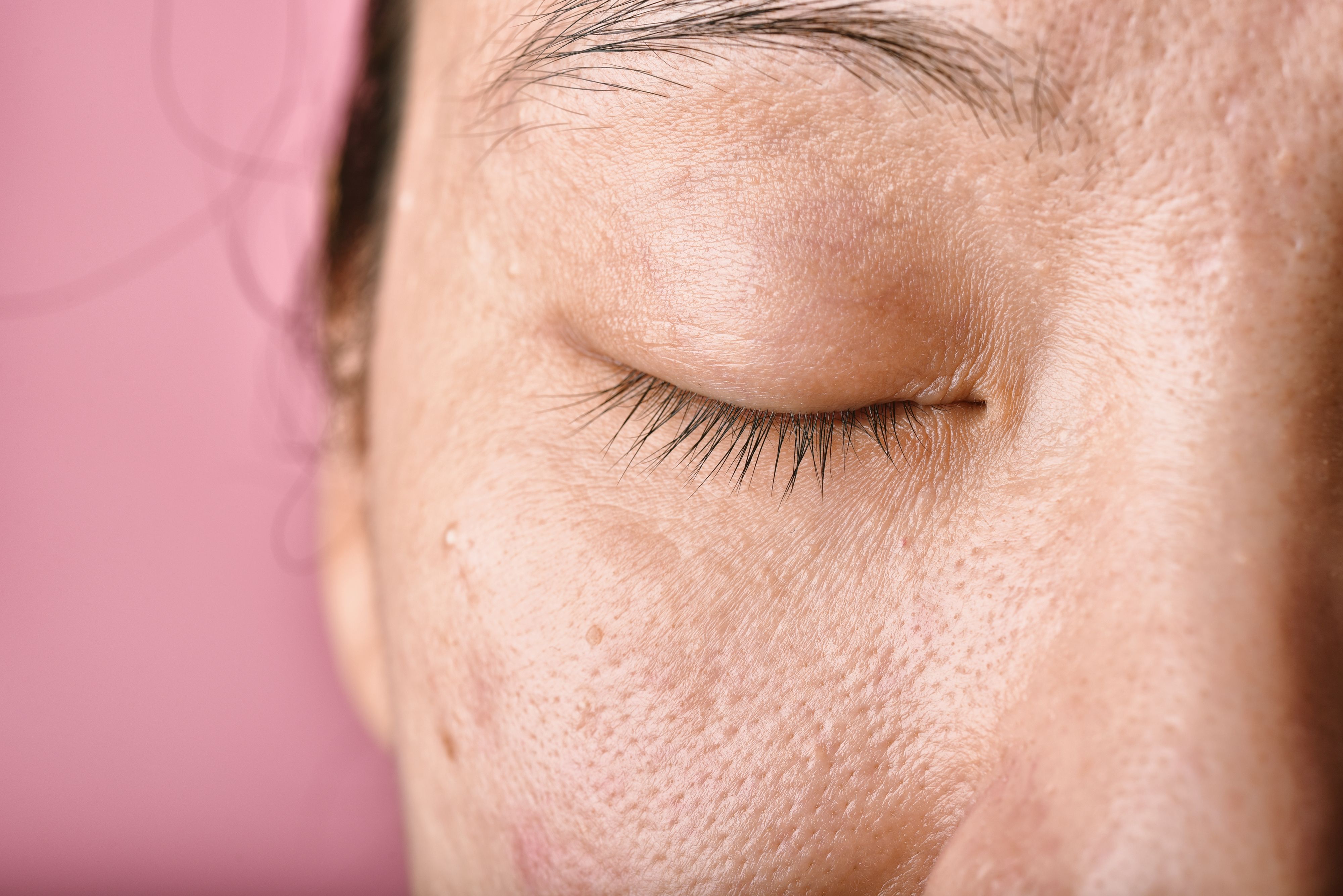 dermatologist london