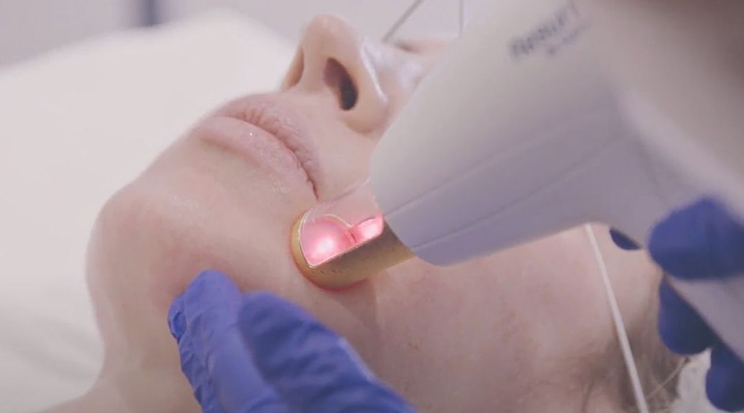 m22 skin rejuvenation treatment procedure