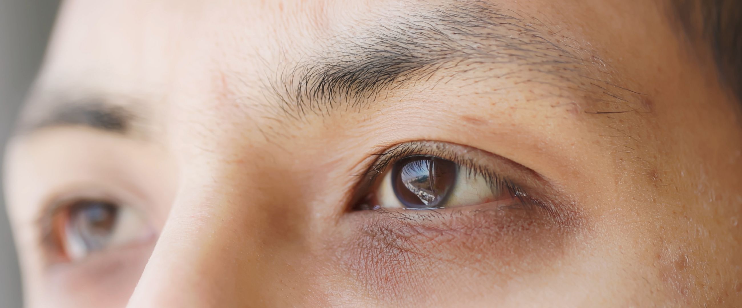 Man With Dark Circles Under Eyes