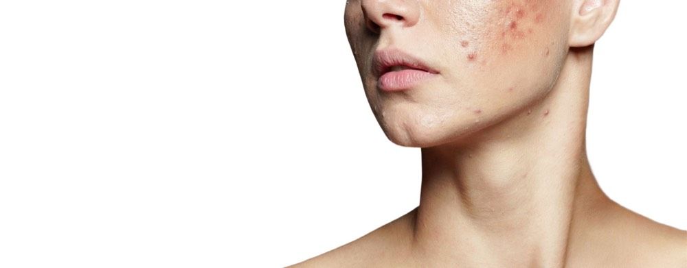 Skin quality at PHI Clinic London
