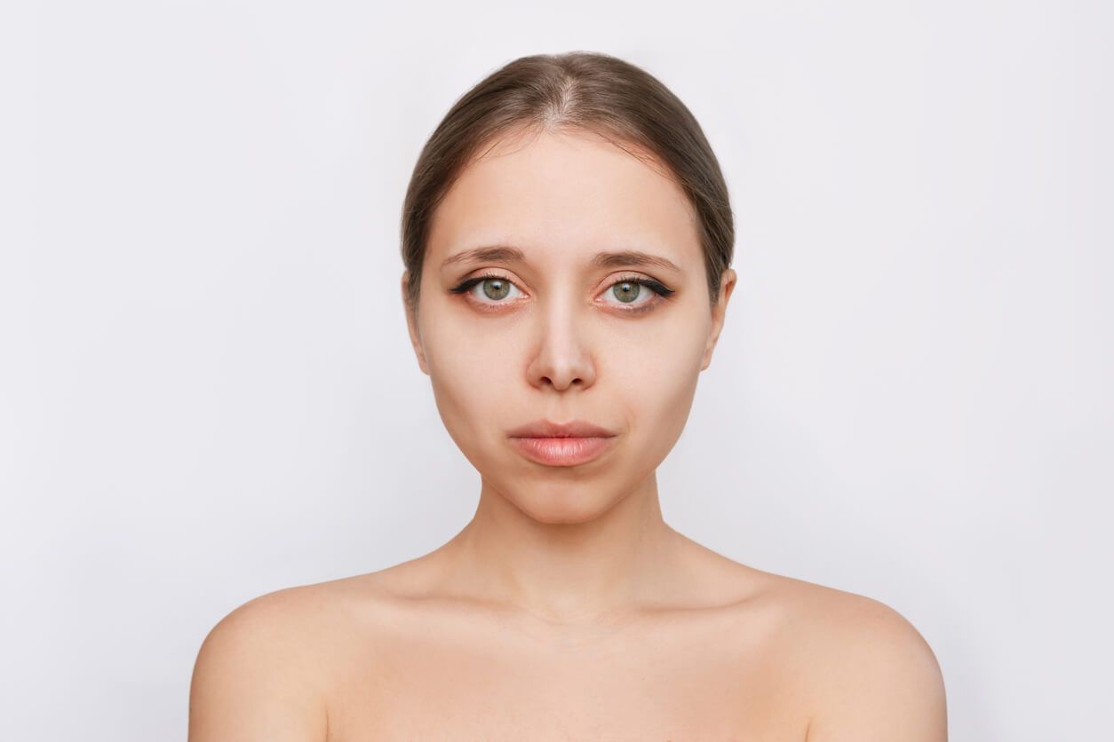 sunken and hollow cheeks treatment