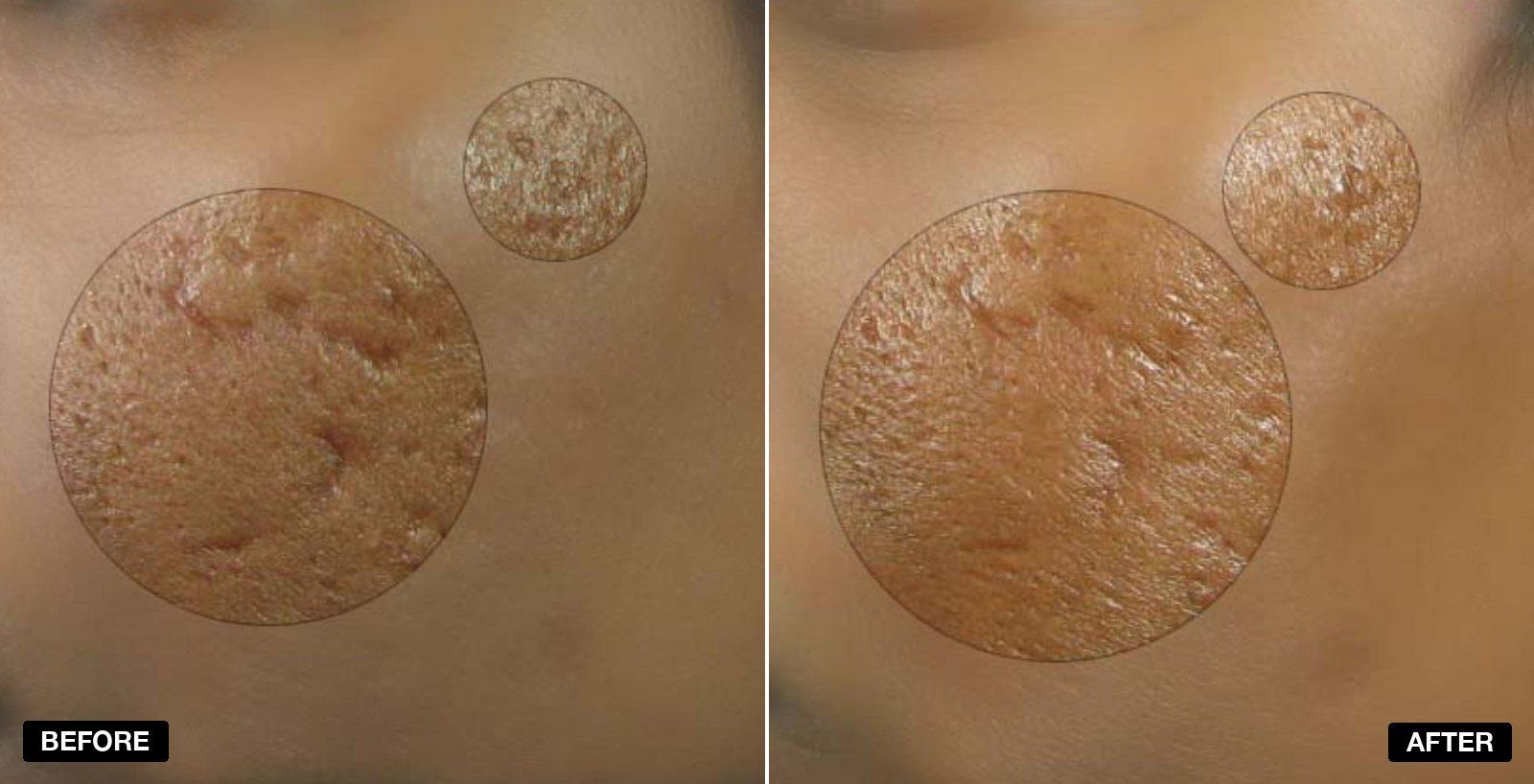 TOTAL FX transformations - patient case 1 of 1 at PHI Clinic London