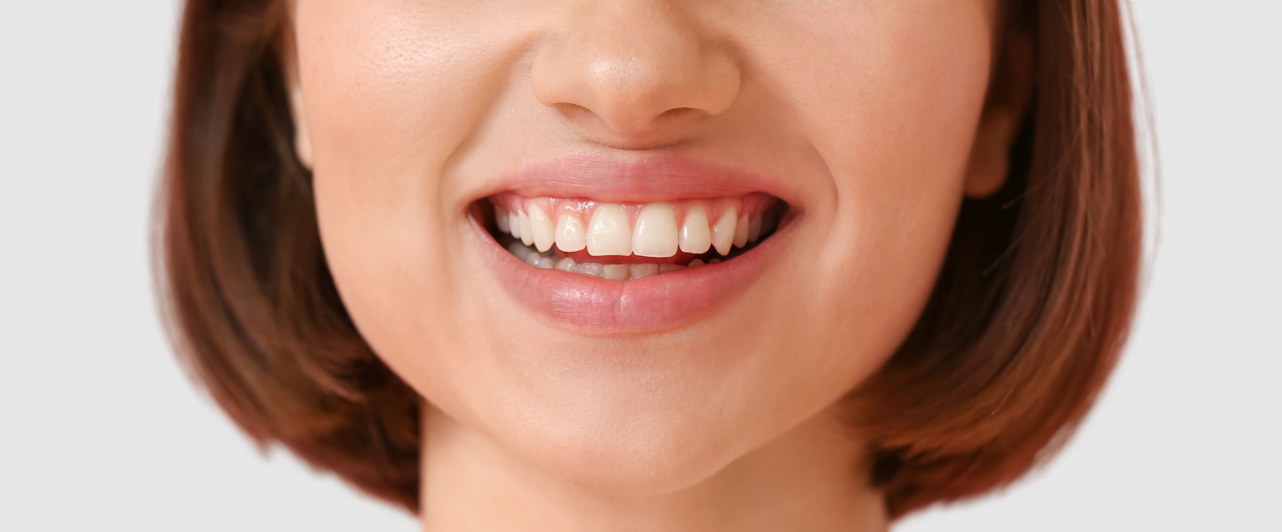 woman smiling showing lip flip result